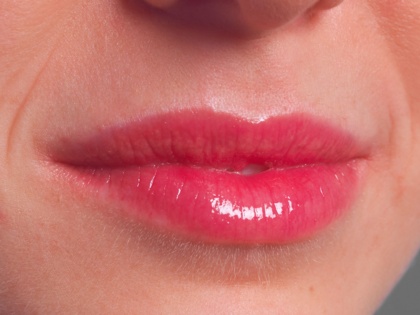 Praxis-Model-Geschlossene-Lippen